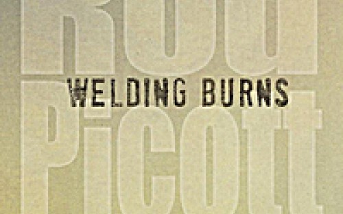 rodpicottweldingburns.jpg